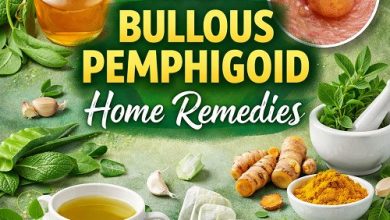 Bullous Pemphigoid Home Remedies