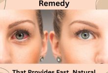 Dry Eyes Herbal Remedy