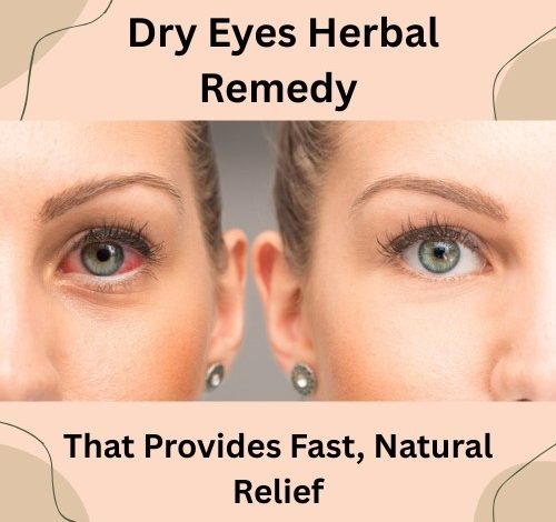Dry Eyes Herbal Remedy