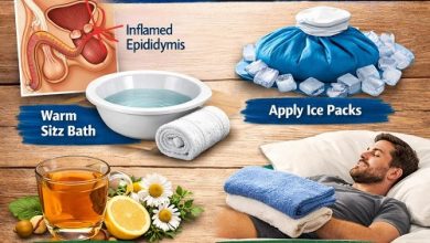 Epididymitis Home Remedies