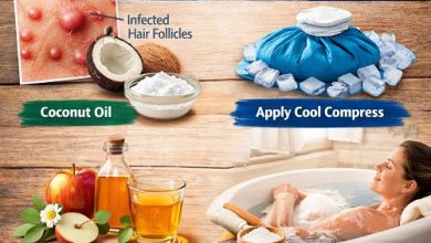 Folliculitis Home Remedies