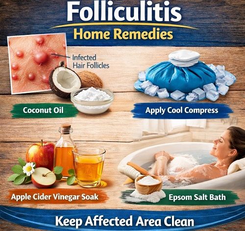 Folliculitis Home Remedies