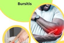 Herbal Remedies for Bursitis