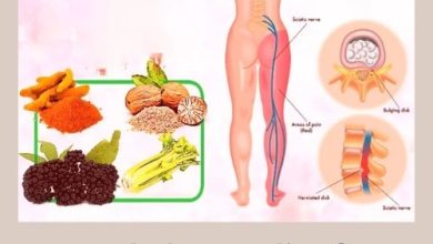 Herbal Remedies for Sciatica