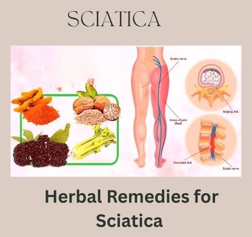 Herbal Remedies for Sciatica