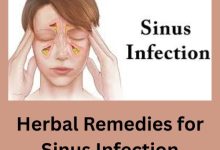 Herbal Remedies for Sinus Infection