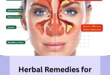 Herbal Remedies for Sinusitis