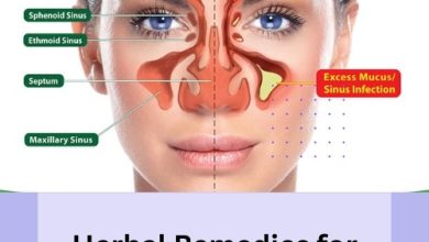 Herbal Remedies for Sinusitis