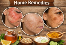 Skin Damage Repair Home Remedies