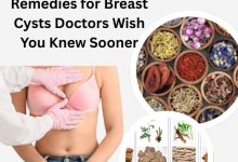 Top 10 Herbal Remedies for Breast Cysts
