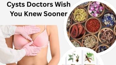 Top 10 Herbal Remedies for Breast Cysts