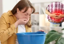 Vomiting Disease Outbreak in South Carolina