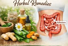 Abdominal Adhesions Herbal Remedies