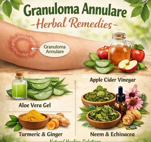 Granuloma Annulare Herbal Remedies