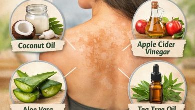 Natural Home Remedies for Tinea Versicolor
