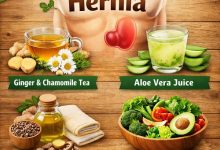 Natural Remedies for Hernia