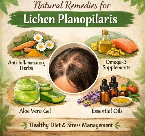 Natural Remedies for Lichen Planopilaris