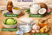 Natural Remedies for Mastitis
