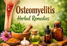 Osteomyelitis Herbal Remedies