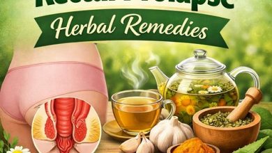Rectal Prolapse Herbal Remedies