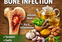 Herbal Remedies for Bone Infection