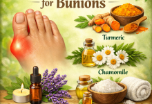 Herbal Remedies for Bunions