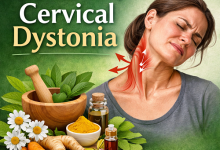 Herbal Remedies for Cervical Dystonia