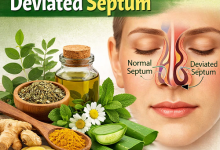 Herbal Remedies for Deviated Septum