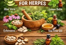 Herbal Remedies for Herpes