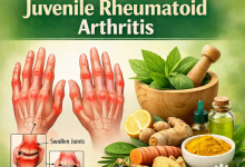Herbal Remedies for Juvenile Rheumatoid Arthritis