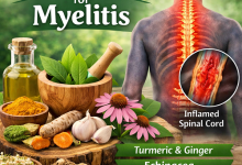 Herbal Remedies for Myelitis
