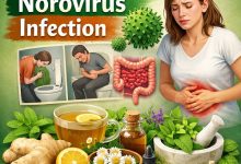 Herbal Remedies for Norovirus Infection