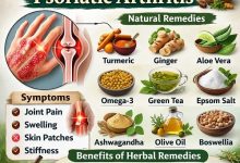 Herbal Remedies for Psoriatic Arthritis