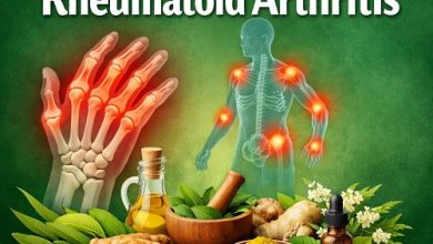 Herbal Remedies for Rheumatoid Arthritis