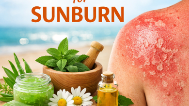Herbal Remedies for Sunburn