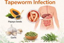 Herbal Remedies for Tapeworm Infection