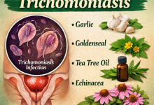 Herbal Remedies for Trichomoniasis