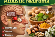 Herbal Remedies for Acoustic Neuroma