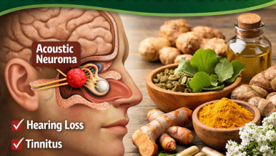 Herbal Remedies for Acoustic Neuroma