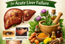 Herbal Remedies for Acute Liver Failure