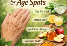 Herbal Remedies for Age Spots