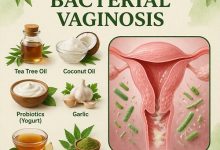 Herbal Remedies for Bacterial Vaginosis