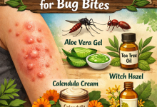Herbal Remedies for Bug Bites
