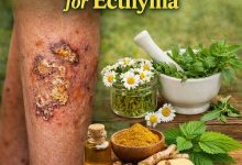 Herbal Remedies for Ecthyma