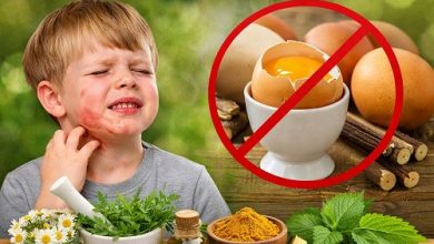 Herbal Remedies for Egg Allergy