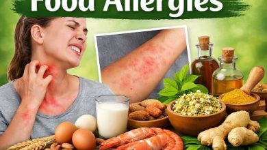Herbal Remedies for Food Allergies