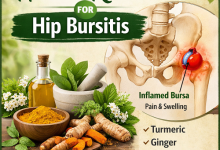 Herbal Remedies for Hip Bursitis