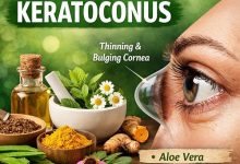 Herbal Remedies for Keratoconus