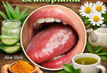 Herbal Remedies for Leukoplakia