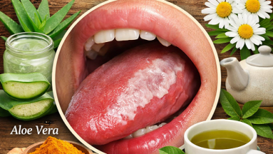 Herbal Remedies for Leukoplakia